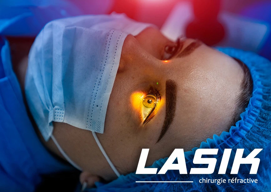 fonctionnement de l'opération LASIK